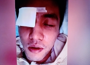 乐动体育在线-关于篮球明星因伤离场，是否能及时复出存疑的信息