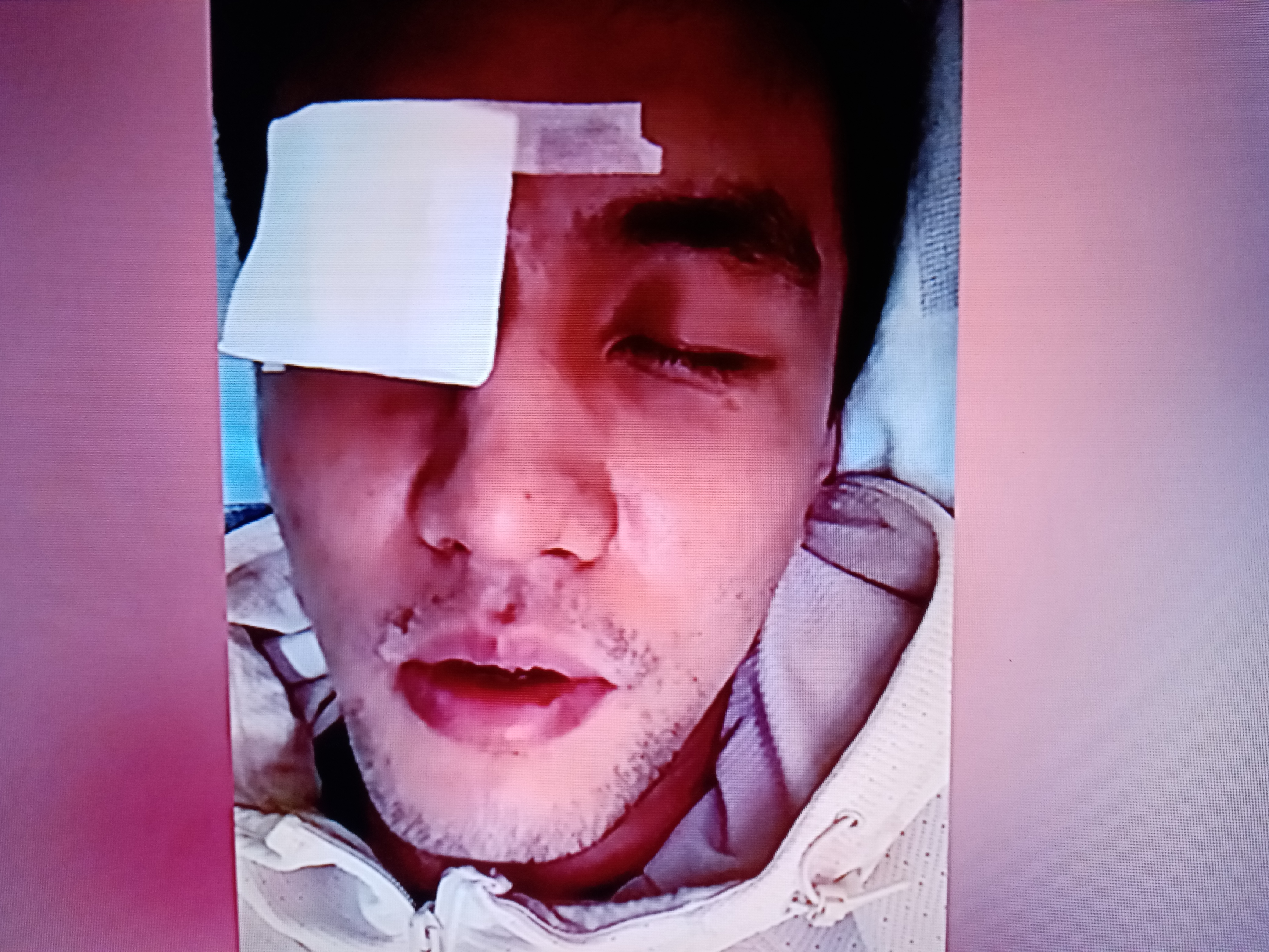 关于篮球明星因伤离场，是否能及时复出存疑的信息